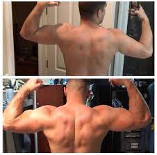 Peak Nutrition - Nevada - 4 weeks before and after pics on our SARM stacks!  Look at the difference in his right arm ,, insane ... For the BEST SARMs at  the